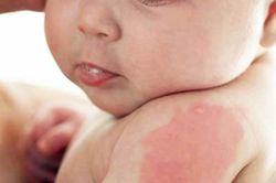Giải mã hiện tượng sinh con khó nuôi