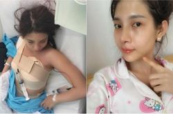 Gái trẻ khoe chiến tích phẫu thuật thẩm mỹ toàn thân