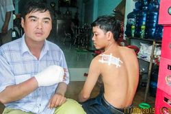 Côn đồ chém người sau cú quẹt xe