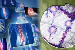 'Bắt mạch' sớm triệu chứng thoái hóa khớp