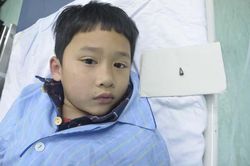 Nội soi lấy dị vật trong phế quản bệnh nhi 7 tuổi