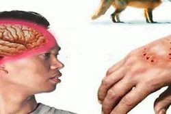 Lý giải việc cứ đến đám tang là phát dại?