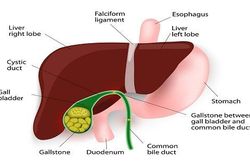 Chủ tịch Hội gan mật Việt Nam giải đáp thắc mắc bệnh sỏi mật