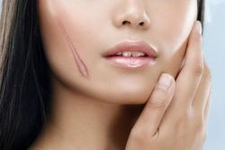 Vị trí vết sẹo xui xẻo khiến chủ nhân gặp họa suốt đời