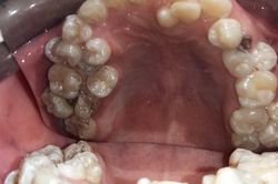Hy hữu: Răng mọc tua tủa trong miệng chàng trai 28
