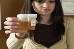 Bác sĩ da liễu cảnh báo về phương pháp làm đẹp bằng nước tiểu