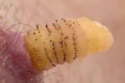 'Phát ớn' trước những sự thật kinh dị về con dòi