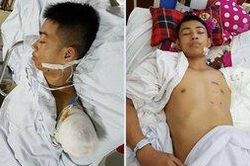 Chàng trai xứ Nghệ bất chấp nguy hiểm để ô tô cán qua tay mình cứu sống bạn?