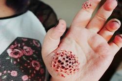 Căn bệnh kinh dị không dành cho người yếu tim xem