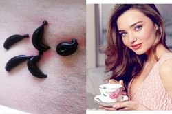 Bí quyết làm đẹp bằng... đỉa của thiên thần Miranda Kerr