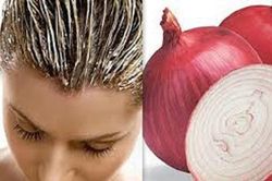 Những mẹo hay để trị gàu hiệu quả khi đông về