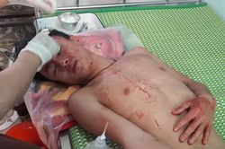 Đề nghị công an vào cuộc vụ hai thầy trò bị đánh nhập viện