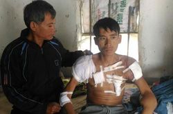 Bi đát tình cảnh chàng trai Nghệ An 28 tuổi 10 năm chạy thận
