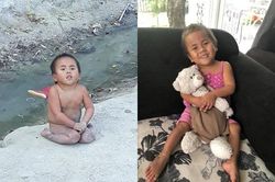 Em bé co ro ở Mường Lát được cặp vợ chồng Sài Gòn nhận nuôi