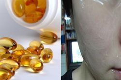 Sai lầm tai hại khi dùng vitamin E không đúng cách khiến nhan sắc bị tổn thương trầm trọng