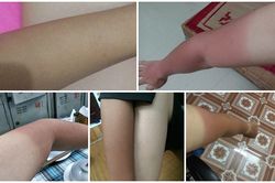Dùng bìa carton chống nóng vẫn không ăn thua, dân mạng bất lực chia sẻ ảnh làn da 'hai màu' vì cháy nắng