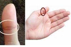Giải mã vận mệnh người có vân mắt phượng ở ngón tay cái