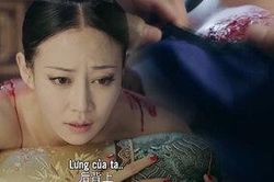 Nếu thắc mắc Cao Quý phi bị bỏng nhưng toàn thân lở loét, hãy đọc để biết về kim trấp trong 'Diên Hi công lược'