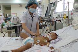Bệnh tay chân miệng: Biến chứng gây tử vong ở trẻ em cha mẹ cần hết sức đề phòng