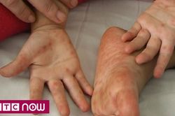 Thấy dấu hiệu này hãy đưa ngay con tới bệnh viện, nếu không muốn trẻ mất mạng