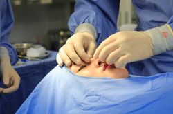 Phẫu thuật thẩm mỹ chui: Khi đi 'lộng lẫy' khi về… 'mất tiêu'