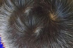 Đếm xoáy trên đỉnh đầu con tiên đoán vận mệnh chính xác