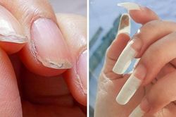 10 liệu pháp tự nhiên đối phó với móng tay yếu, dễ gãy