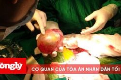 Bé trai 4 tháng tuổi mang 'thai trong thai' hiếm gặp