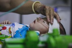 Lo ngại dịch sởi bùng phát diện rộng trong dịp Tết Nguyên đán