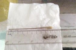 Gắp thành công tăm tre dài gần 10 cm ra khỏi phổi cụ ông