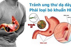 85,8% người lớn nhiễm vi khuẩn HP – nguyên nhân gây ung thư dạ dày