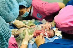 Hy hữu: Cặp song sinh chào đời dính liền nhau, có chung hậu môn