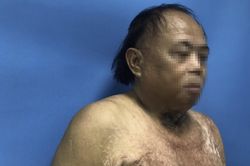 Nghe lời thầy bói, vợ tạt axit chồng để trục vong
