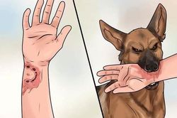 Những cách sơ cứu khi bị chó tấn công tránh mắc bệnh dại