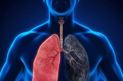 Phát hiện loài cây rừng kháng được bốn dòng ung thư