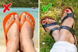 Mùa hè đi dép xỏ ngón và những tác hại khôn lường không phải ai cũng biết