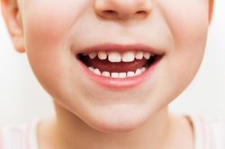 Lấy gần 100 cái răng trong miệng thiếu niên ở Khánh Hòa