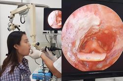 Cô gái Hải Phòng không nói được, sụt 14kg trong 1 năm chỉ từ vết loét nhỏ