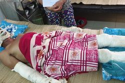 Phát nổ do rò rỉ khí ga trong đám tang, 5 người bỏng nặng