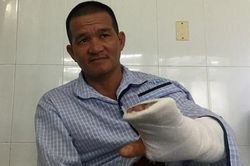 'Hiệp sĩ' bị kẻ ngáo đá chém đứt gân tay