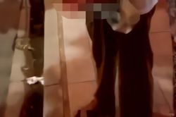Cảnh giác với 'bút bi phát nổ': Tò mò nhặt lên mất bàn tay như chơi!