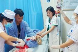 Máy cắt cỏ băm nát 2 bàn chân bé trai