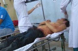 'Xưng hùng xưng bá' giữa đường bị chém suýt chết