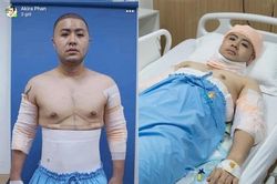 Sau khi bỏ 300 triệu phẫu thuật toàn diện, Akira Phan lộ diện gây bất ngờ