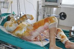 Nướng mực bằng cách này chẳng khác nào tự 'nướng người'