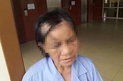 Công an điều tra cháu trai nghi trói chân tay, bịt mồm đánh bà ngoại gãy 5 xương sườn
