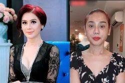 Lâm Khánh Chi gây bất ngờ với gương mặt sần sùi, nhiều nốt