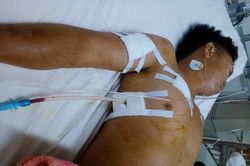 Truy tìm kẻ côn đồ xông vào nhà đâm trọng thương nam thanh niên trong đêm
