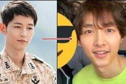 Fan lo lắng Song Joong Ki bị hói đầu vì căng thẳng hôn nhân với Song Hye Kyo