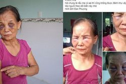 Thực hư chuyện con dâu đánh mẹ chồng bầm tím mặt mũi đang lan truyền trên mạng xã hội